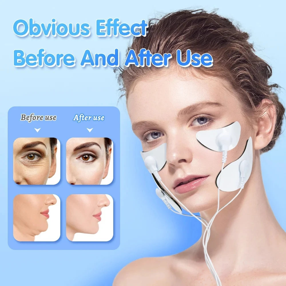 EMS Facial Massager Eye Face Lift Skin Tightening Anti-Wrinkle V-Shaped Face Muscle Stimulator Beauty Device